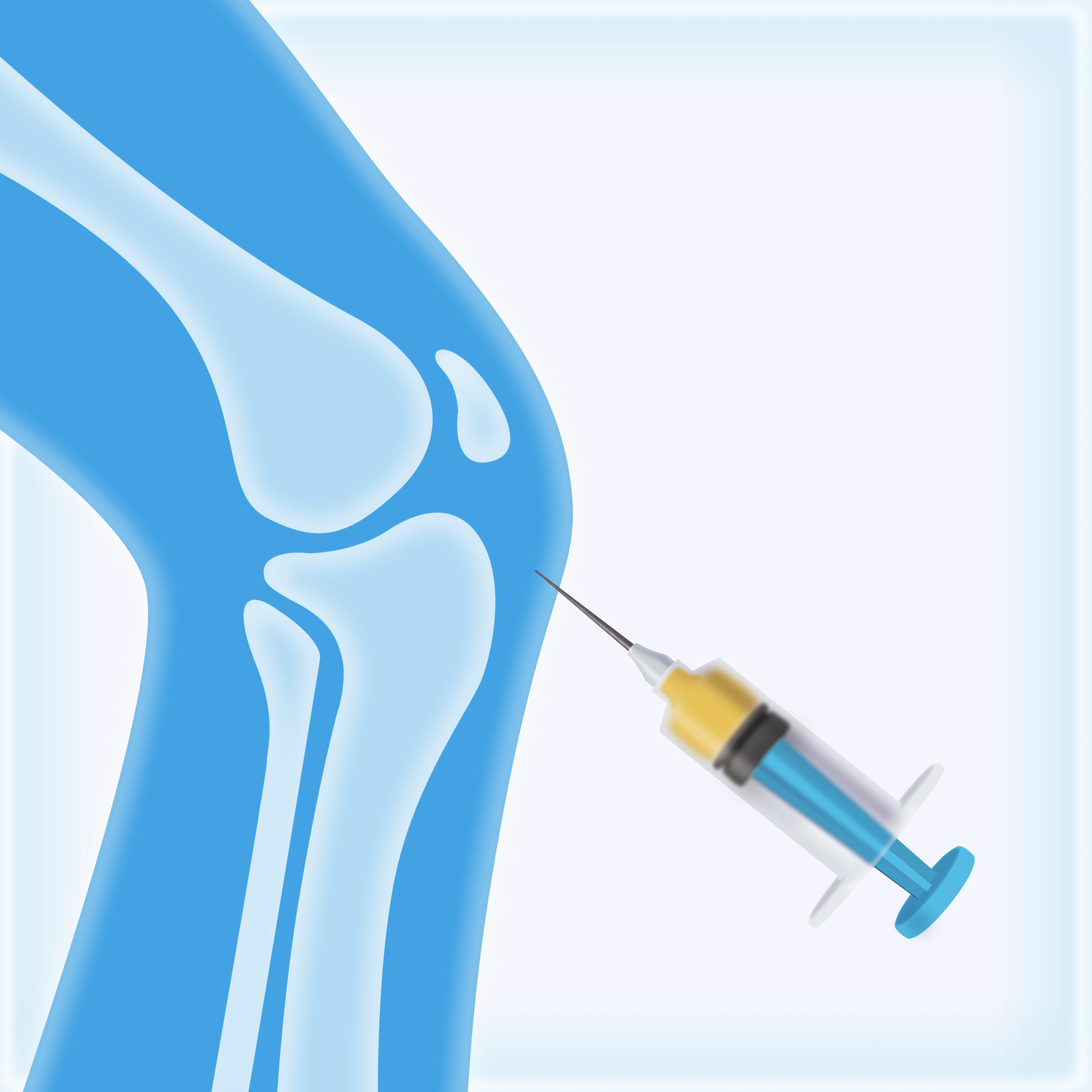 PRP Therapy in Sports Medicine